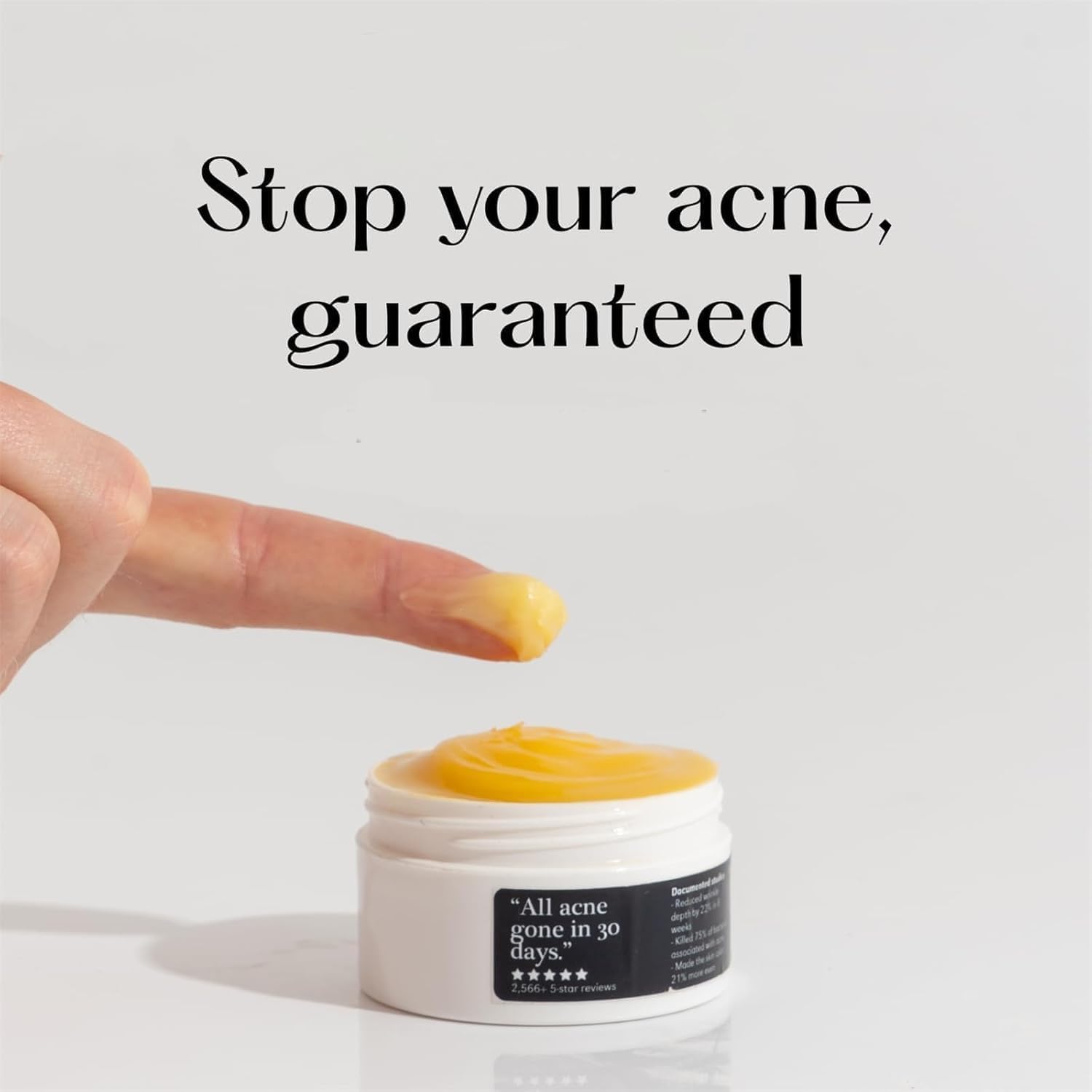 Norse Organics Acne,Norse Organics Acne & Redness Killer,Norse Organics Acne Balm,Ultra-Performance Skincare,Acne Clearing Cream for Man (2pcs) - OutsideCool