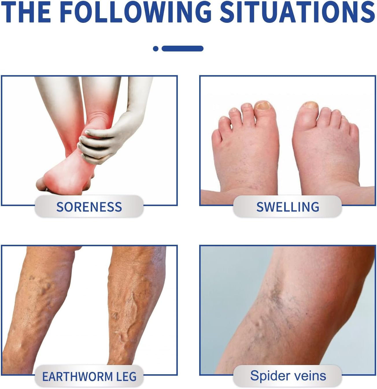 Varicose Vein Relief Massage Cream - Varicose Veins Cream for Legs, Feet, and Ankles, Soothe Discomfort, 20g - OutsideCool