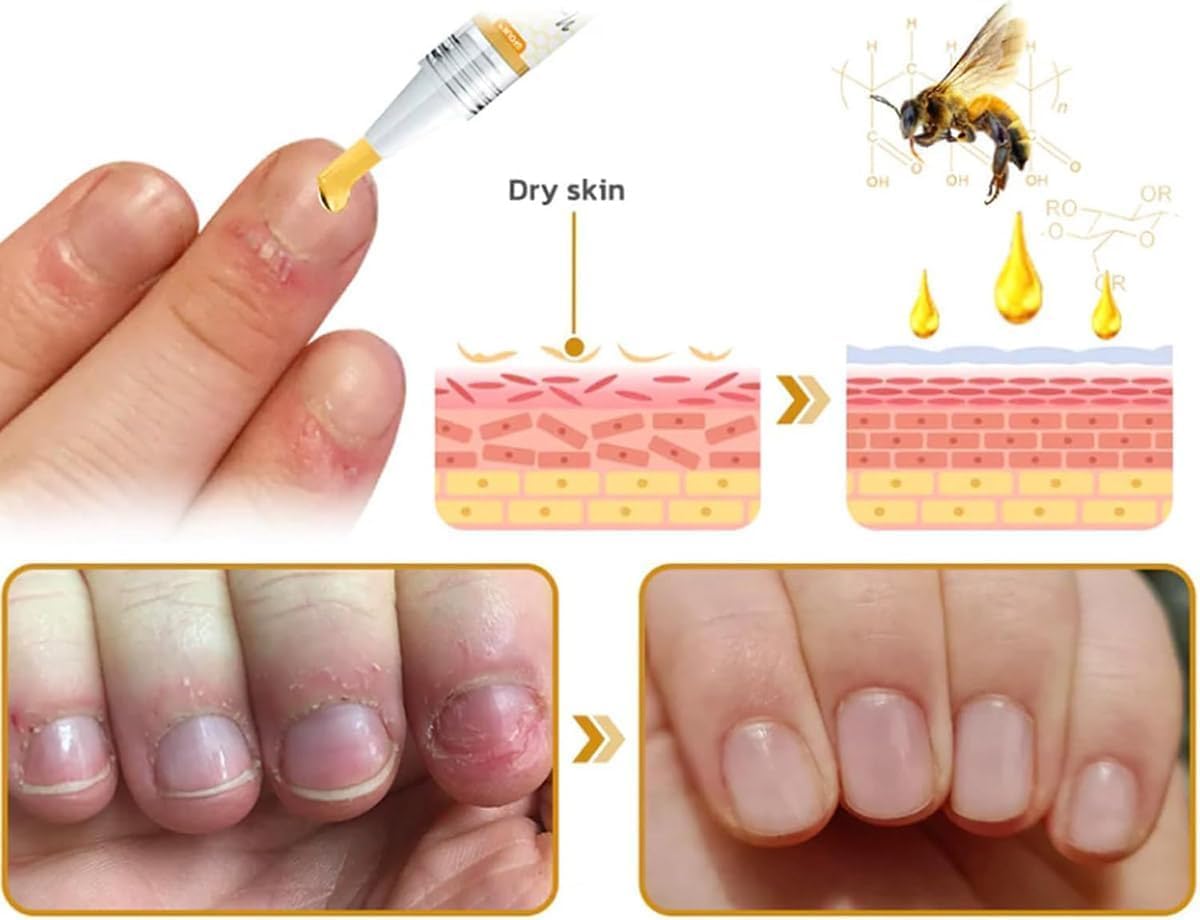 3Pcs Nailplus Strong 7 Days Growth Nail Gel,Nail Growth and Repair Serum,Nail Growth and Strengthener Essence,Nail Strengthener for Damaged Nails - OutsideCool