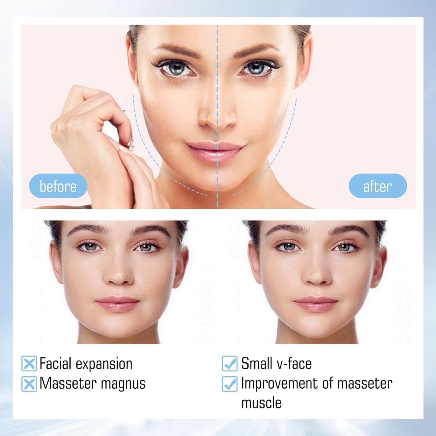 10Pcs Bloskin Double Chin Mask Reusable,Bloskin Double Chin Mask,V Line Lifting Mask Double Chin Reducer,V Line Lifting Mask - OutsideCool