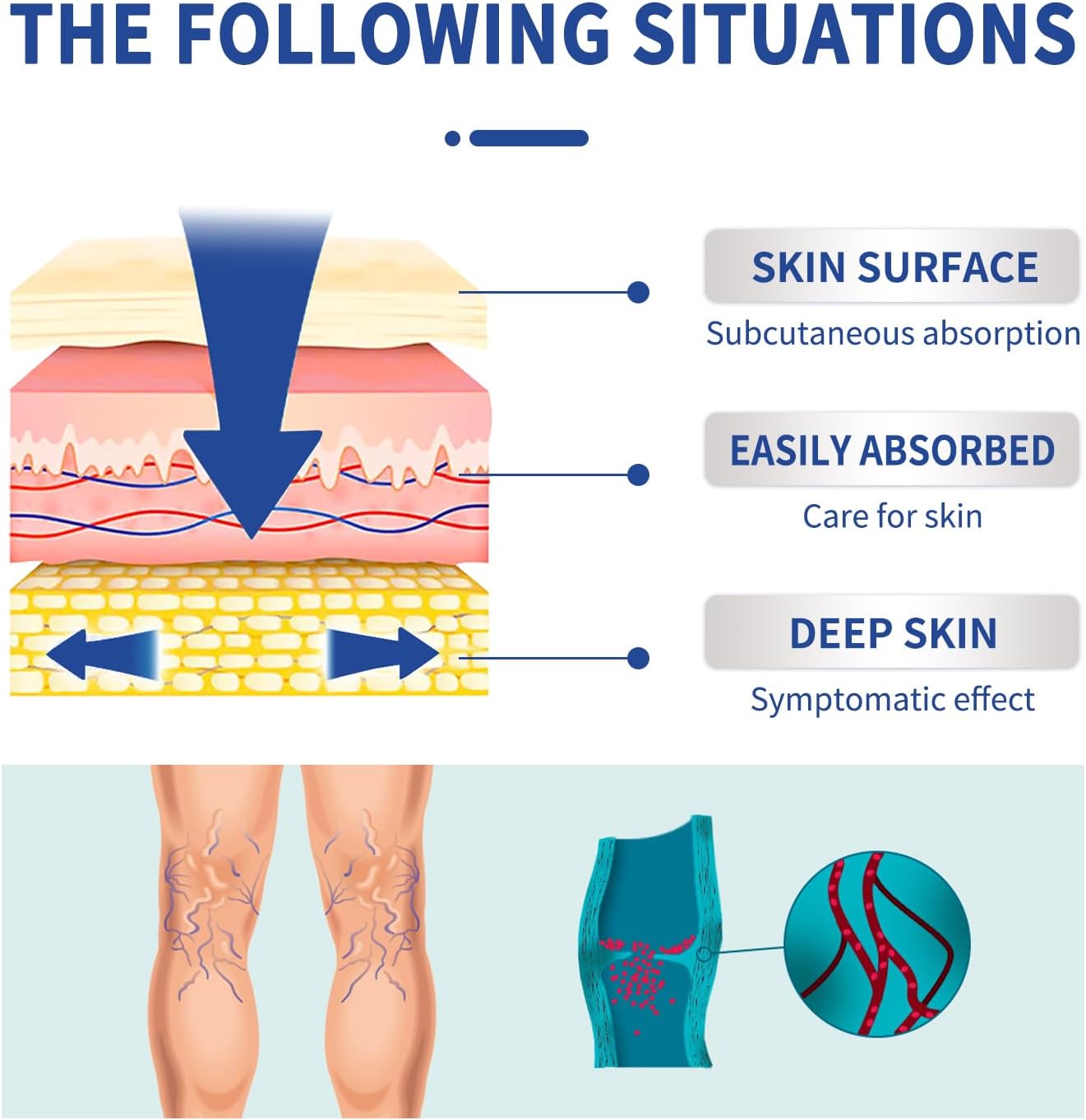 Varicose Vein Relief Massage Cream - Varicose Veins Cream for Legs, Feet, and Ankles, Soothe Discomfort, 20g - OutsideCool
