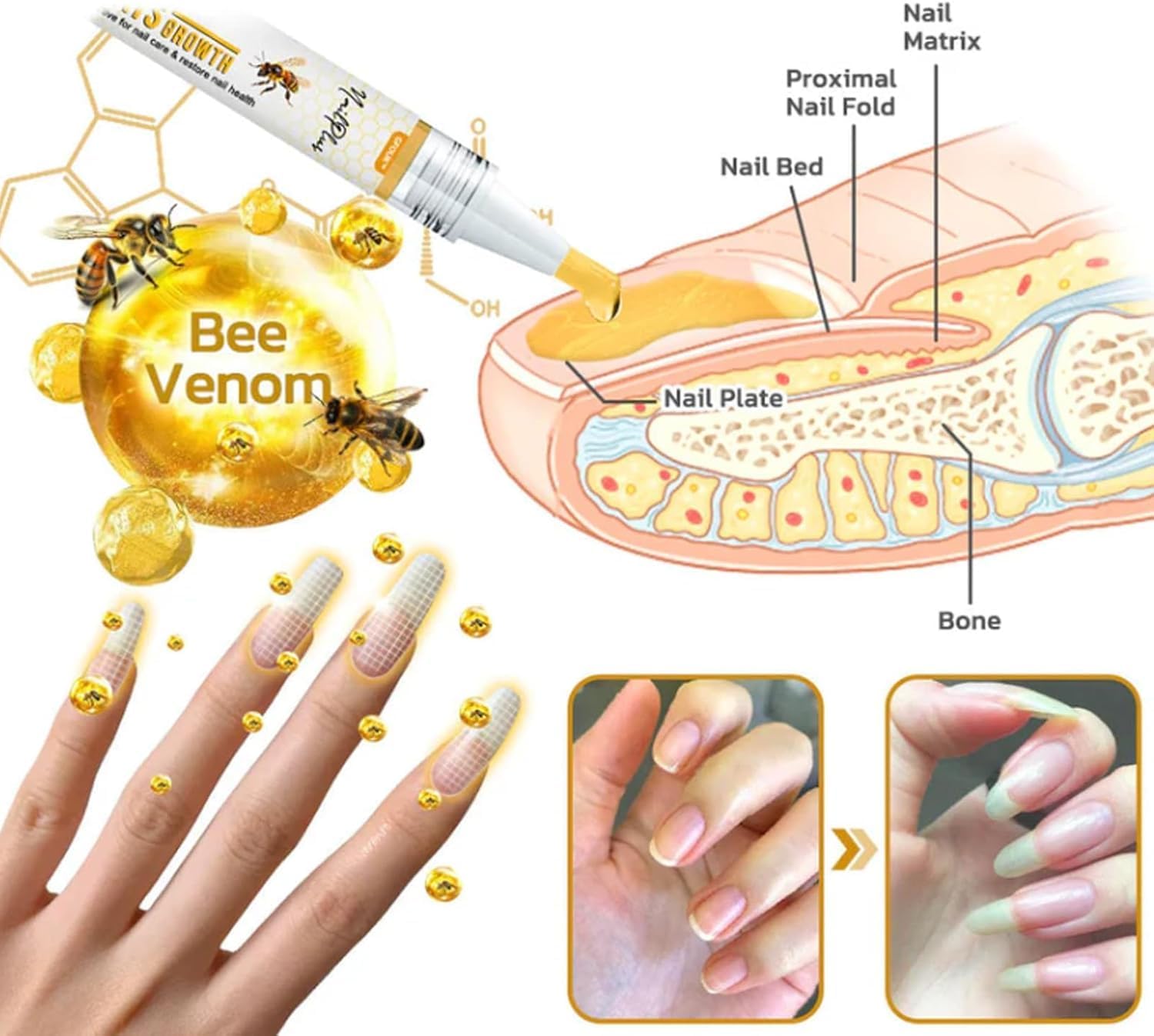 3Pcs Nailplus Strong 7 Days Growth Nail Gel,Nail Growth and Repair Serum,Nail Growth and Strengthener Essence,Nail Strengthener for Damaged Nails - OutsideCool