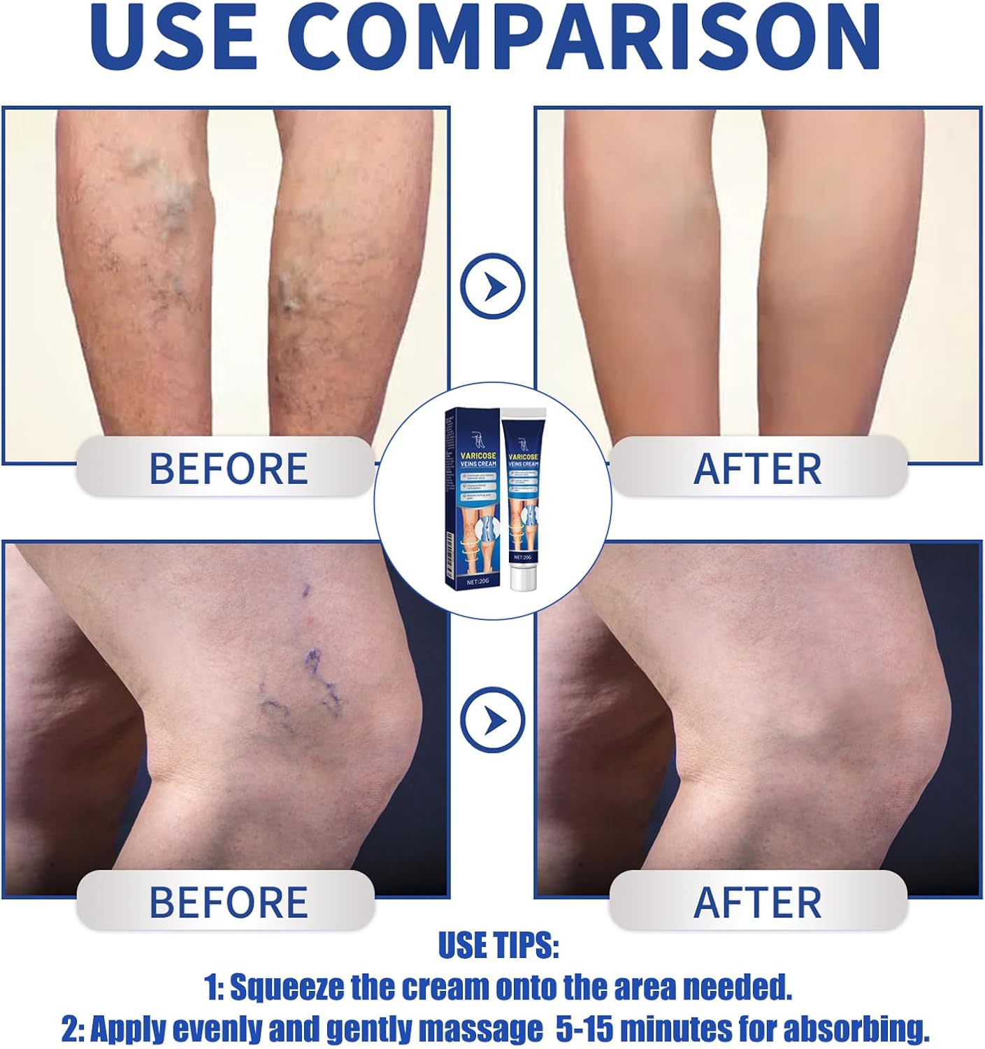 Varicose Vein Relief Massage Cream - Varicose Veins Cream for Legs, Feet, and Ankles, Soothe Discomfort, 20g - OutsideCool