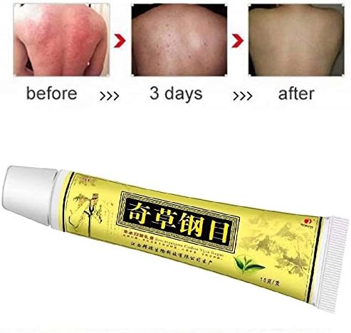 6 Pcs Eczema, Psoriasis, Anti-Itch Cream External Use Only, Dermatitis,Inflammation and Rashes, Anti Itch Cream Extra Strength