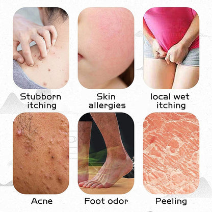 6 Pcs Eczema, Psoriasis, Anti-Itch Cream External Use Only, Dermatitis,Inflammation and Rashes, Anti Itch Cream Extra Strength