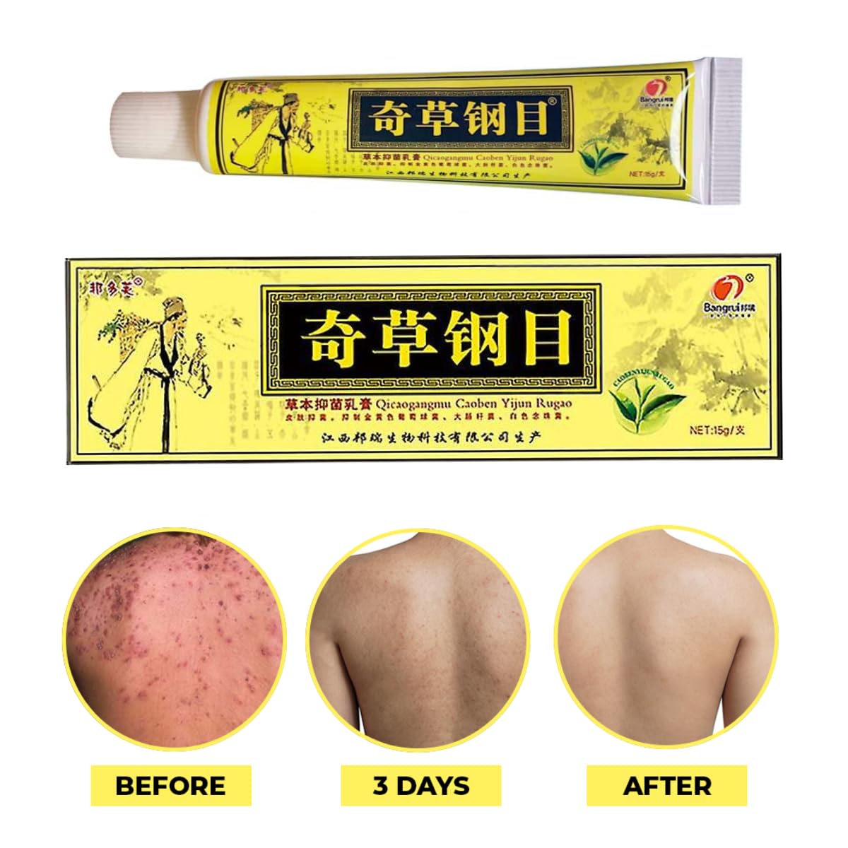 Official Seller - Chinese Herbal Cream - Natural Relief for Skin Issues - Pack of 5 - OutsideCool