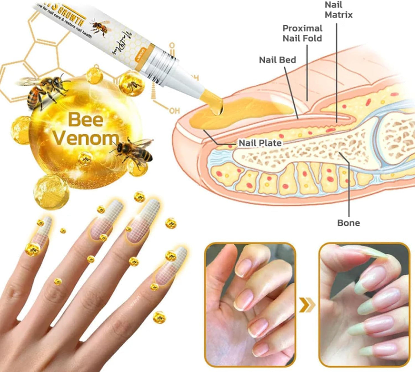 3Pcs Nailplus Strong 7 Days Growth Nail Gel,Nail Growth and Repair Serum,Nail Growth and Strengthener Essence,Nail Strengthener for Damaged Nails - OutsideCool