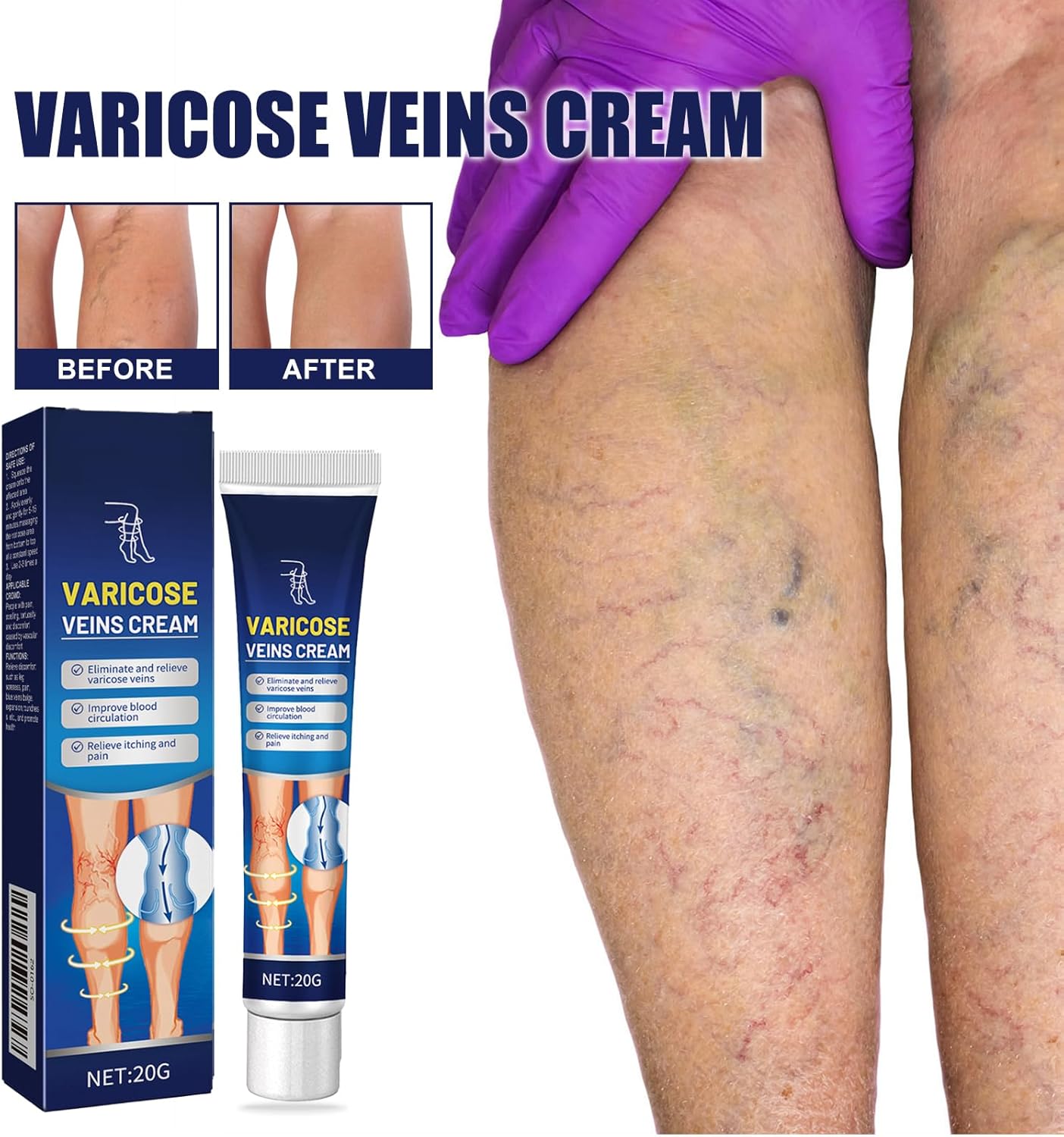 Varicose Vein Relief Massage Cream - Varicose Veins Cream for Legs, Feet, and Ankles, Soothe Discomfort, 20g - OutsideCool