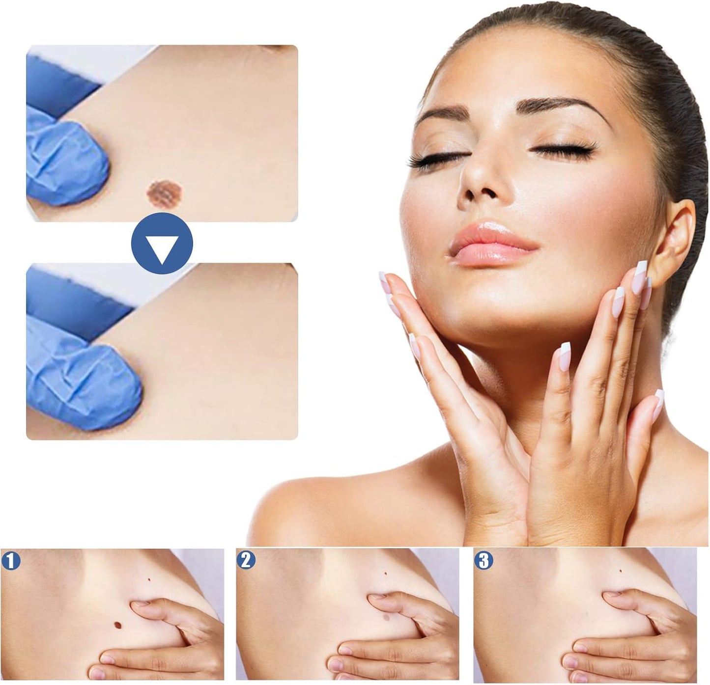 144 PCS Skin Tag Patches/New & Improved Formula Skin Tag Patche/Suitable for All Body - OutsideCool