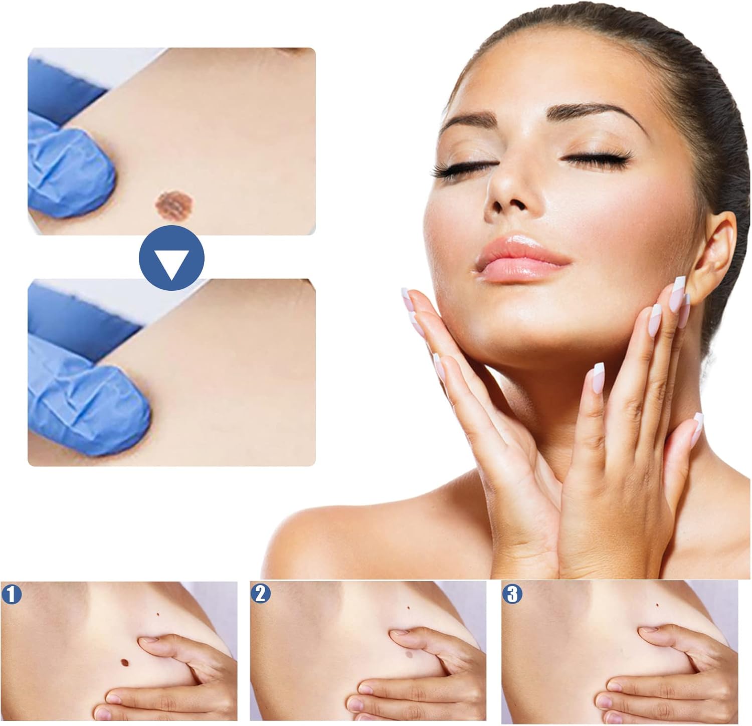 144 PCS Skin Tag Patches/New & Improved Formula Skin Tag Patche/Suitable for All Body - OutsideCool