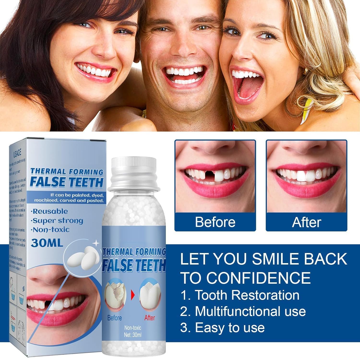 Tooth Repair Kit/Tooth Repair Granules/Cavity Filler for Teeth/Tooth Repair Kit for Chipped Teeth/Cavity Filler for Teeth/Temporary Filling for Tooth/Kit de réparation de dents/Temporary Filling for Tooth - OutsideCool