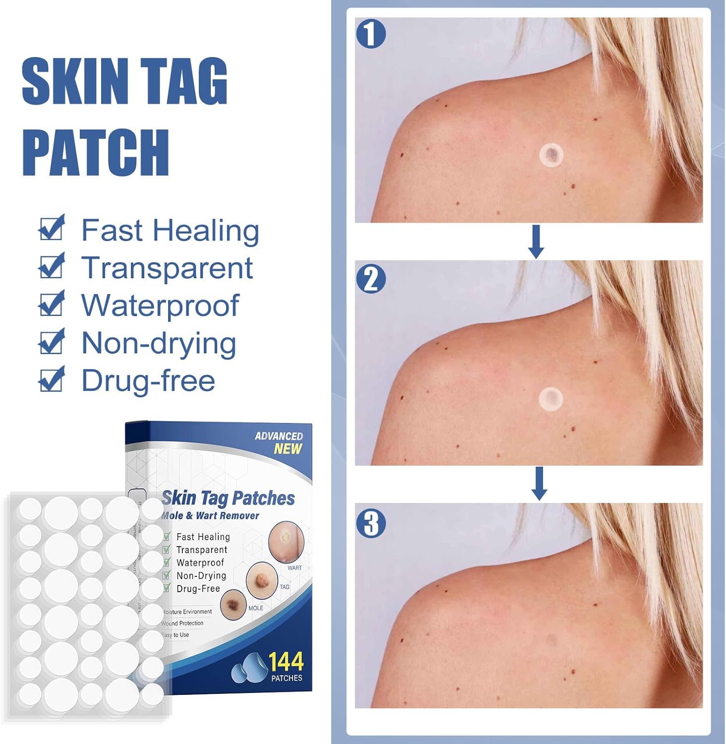 144 PCS Skin Tag Patches/New & Improved Formula Skin Tag Patche/Suitable for All Body - OutsideCool