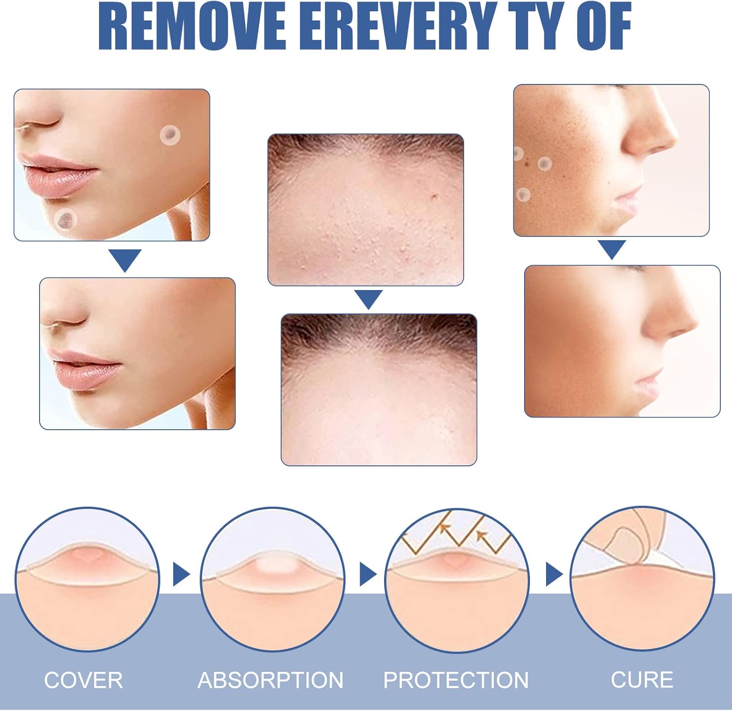 144 PCS Skin Tag Patches/New & Improved Formula Skin Tag Patche/Suitable for All Body - OutsideCool